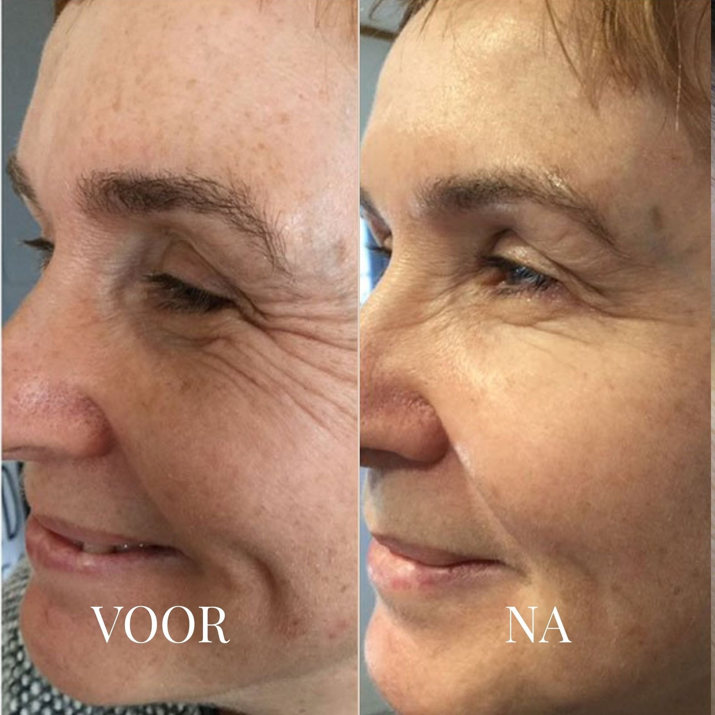 BALANCEBLOOM ANTI-AGING BALM